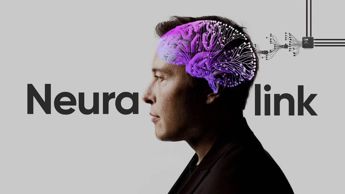 Человеку впервые в истории вживили в мозг чип Neuralink, сообщил Илон Маск